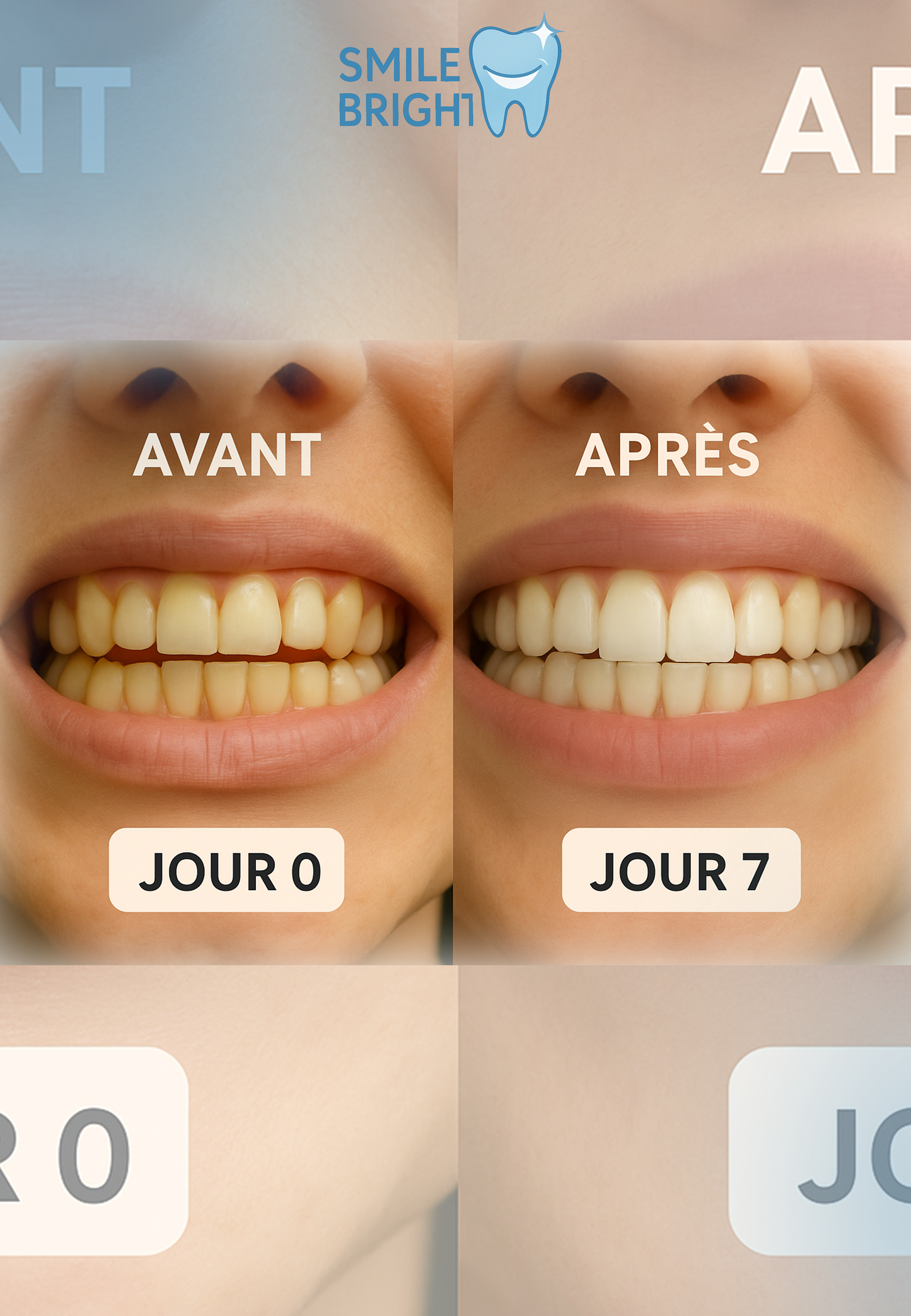 Bandes Blanchissantes Traitement 7 Jour – Effet Professionnel by Smile Bright